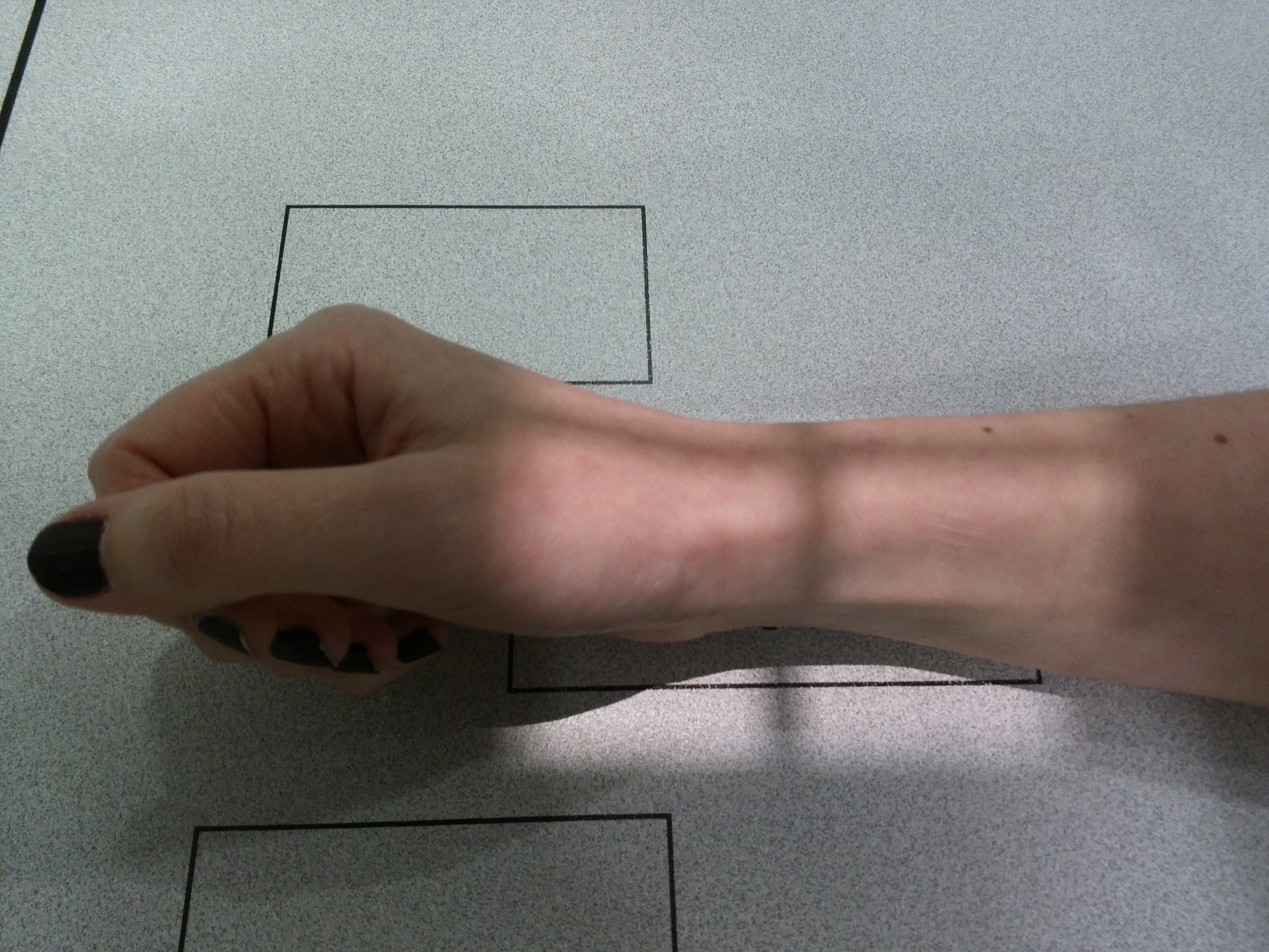 Radiografía Lateral de Muñeca